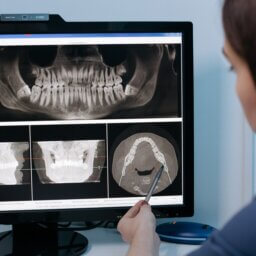 are dental x-rays safe